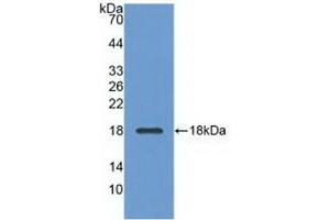 Detection of Recombinant ADP, Bovine using Polyclonal Antibody to Adiponectin (ADPN) (ADIPOQ Antikörper  (AA 103-240))