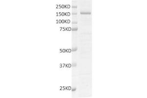 Recombinant PHF8 protein gel. (PHF8 Protein (DYKDDDDK Tag))