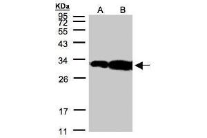 WB Image Sample(30 μg of whole cell lysate) A:Hep G2, B:MOLT4, 12% SDS PAGE antibody diluted at 1:500 (HOXC11 Antikörper)