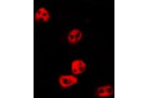 ABIN6274018 staining HepG2 by IF/ICC. (Histone 3 Antikörper  (H3K14me, H3K14me2, H3K14me3))