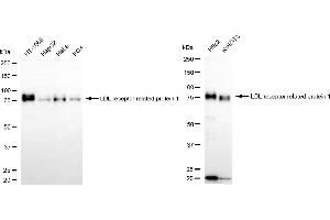 Western blotting analysis using LDL receptor related protein 1 antibody (ABIN7799281).
