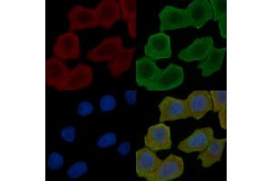ABIN6259203 and ABIN6275587 staining Hela cells(30 min of UV treatment) by IF/ICC.