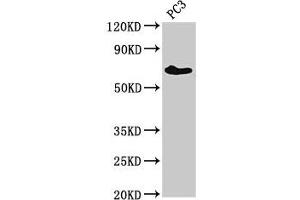 Western Blot Positive WB detected in: PC-3 whole cell lysate All lanes: ICK antibody at 3 μg/mL Secondary Goat polyclonal to rabbit IgG at 1/50000 dilution Predicted band size: 72, 35 kDa Observed band size: 72 kDa (ICK Antikörper  (AA 150-275))