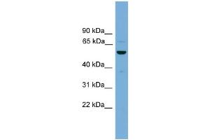 WB Suggested Anti-ASZ1 Antibody Titration: 1. (ASZ1 Antikörper  (Middle Region))