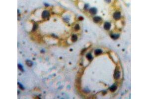 IHC-P analysis of Kidney tissue, with DAB staining. (ACVR1 Antikörper  (AA 208-340))