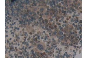 Detection of NCF4 in Mouse Spleen Tissue using Polyclonal Antibody to Neutrophil Cytosolic Factor 4 (NCF4)