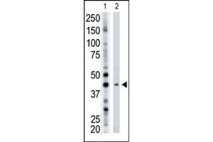 The anti-ART3 Pab (ABIN389010 and ABIN2839235) is used in Western blot to detect ART3 in mouse brain tissue lysate.