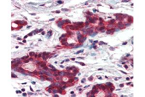 Anti-MMP14 antibody IHC of human breast. (MMP14 Antikörper  (AA 160-173))