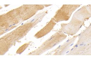 Detection of TTN in Human Skeletal muscle Tissue using Polyclonal Antibody to Titin (TTN) (Titin Antikörper  (AA 33779-34025))