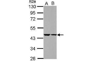WB Image Sample (30 ug of whole cell lysate) A: HeLa B: HepG2 10% SDS PAGE antibody diluted at 1:1000 (C18ORF25 Antikörper)