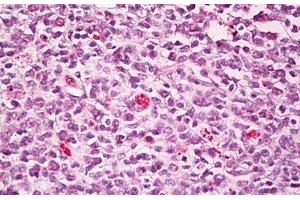 Anti-SWAP70 antibody IHC staining of human tonsil, germinal center. (SWAP70 Antikörper  (AA 1-50))