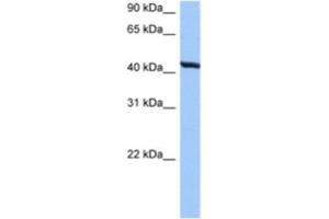 Western Blotting (WB) image for anti-Ring Finger Protein, Transmembrane 2 (RNFT2) antibody (ABIN2463317) (RNFT2 Antikörper)