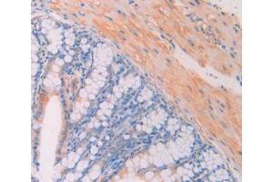 IHC-P analysis of Mouse Large Intestine Tissue, with DAB staining. (CA7 Antikörper  (AA 58-217))