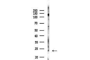 anti-Mesenchymal Stem Cell Protein DSCD75 (THEM6) antibody