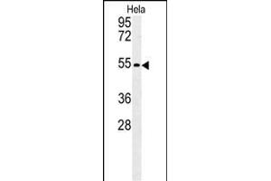 KLF17 Antibody (C-term) (ABIN651698 and ABIN2840365) western blot analysis in Hela cell line lysates (35 μg/lane). (KLF17 Antikörper  (AA 243-271))