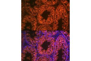 Immunofluorescence analysis of mouse testis using Lin28 Rabbit mAb (ABIN7268266) at dilution of 1:100 (40x lens). (LIN28A Antikörper)