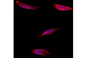 ABIN6265040 and ABIN6273317 staining Hela by IF/ICC. (SGCG Antikörper  (C-Term))