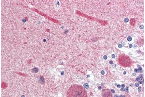 Human Brain, Cerebellum (formalin-fixed, paraffin-embedded) stained with Calmodulin antibody ABIN364349 at 10 ug/ml followed by biotinylated anti-mouse IgG secondary antibody ABIN481714, alkaline phosphatase-streptavidin and chromogen. (Calmodulin 1 Antikörper  (AA 1-149))