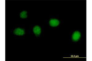Immunofluorescence of purified MaxPab antibody to C1orf73 on HeLa cell. (INTS7 Antikörper  (AA 1-962))