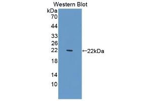 Western Blotting (WB) image for anti-Serpin Peptidase Inhibitor, Clade G (C1 Inhibitor), Member 1 (SERPING1) (AA 148-270) antibody (ABIN7431434)