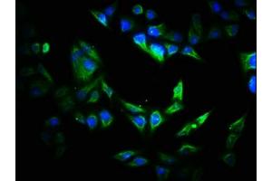 Immunofluorescence staining of Hela cells with ABIN7170532 at 1:200, counter-stained with DAPI. (VIPAR Antikörper  (AA 1-493))
