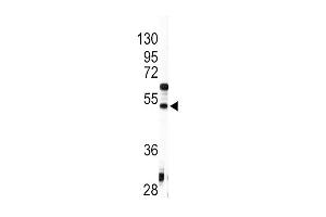 Western blot analysis of anti-AGT Antibody (C-term) (ABIN392328 and ABIN2841975) in HepG2 cell line lysates (35 μg/lane). (AGT Antikörper  (C-Term))