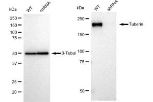 Western blotting analysis using Tuberin antibody (ABIN7800658). (Rekombinanter Tuberin Antikörper)