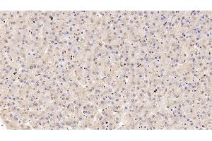 Detection of COMT in Human Liver Tissue using Polyclonal Antibody to Catechol-O-Methyltransferase (COMT) (COMT Antikörper  (AA 52-271))