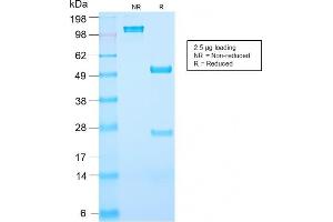 SDS-PAGE Analysis Purified PSA Rabbit Recombinant Monoclonal Antibody (KLK3/2871R). (Rekombinanter Prostate Specific Antigen Antikörper)