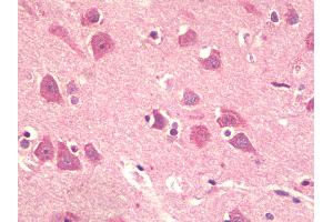 Anti-KPNA5 antibody IHC staining of human brain, cortex.