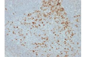 Formalin-fixed, paraffin-embedded human Lymph Node stained with Proliferation Marker Mouse Monoclonal Antibody (JC1). (Proliferation Marker Antikörper)