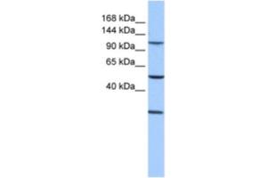 Western Blotting (WB) image for anti-Stromal Antigen 3 (STAG3) antibody (ABIN2463593)