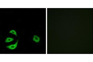 Immunofluorescence analysis of A549 cells, using ACOT8 antibody. (ACOT8 Antikörper)