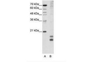 Image no. 1 for anti-Transcription Factor MafF (MAFF) (AA 33-82) antibody (ABIN203018) (MafF Antikörper  (AA 33-82))