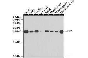 Western blot analysis of extracts of various cell lines using RPL9 Polyclonal Antibody at dilution of 1:1000. (RPL9 Antikörper)