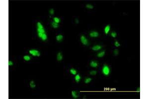 Immunofluorescence of monoclonal antibody to UBE2C on HeLa cell.