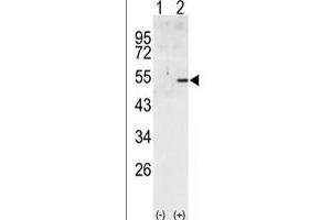 Western blot analysis of CCNA2 (arrow) using rabbit polyclonal CCNA2 Antibody (C-term) (ABIN391455 and ABIN2841432). (Cyclin A Antikörper  (C-Term))