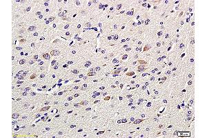Formalin-fixed and paraffin embedded: rat brain tissue labeled with Anti-GAP-43 Polyclonal Antibody, Unconjugated (ABIN725555) at 1:200 followed by conjugation to the secondary antibody and DAB staining (GAP43 Antikörper  (AA 9-100))