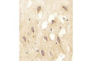 (ABIN655717 and ABIN2845167) staining NOS2A in Human brain tissue sections by Immunohistochemistry (IHC-P - paraformaldehyde-fixed, paraffin-embedded sections).