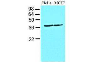 Western Blotting (WB) image for anti-Casein Kinase 1, alpha 1 (CSNK1A1) (AA 1-337), (N-Term) antibody (ABIN371879) (CSNK1A1 Antikörper  (N-Term))