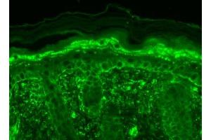 Immunohistochemistry (IHC) image for anti-Transient Receptor Potential Cation Channel, Subfamily V, Member 3 (TRPV3) (AA 458-474) antibody (APC) (ABIN2485241)