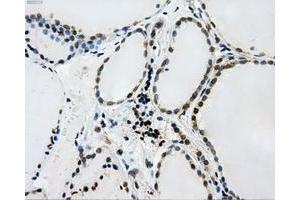 Immunohistochemical staining of paraffin-embedded Kidney tissue using anti-L1CAMmouse monoclonal antibody.