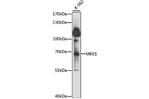 Western blot analysis of extracts of K-562 cells, using MKKS antibody (ABIN6293382) at 1:1000 dilution. (MKKS Antikörper)
