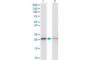 Western Blotting (WB) image for anti-Ribosomal Protein S5 (RPS5) (AA 106-204) antibody (ABIN519884)
