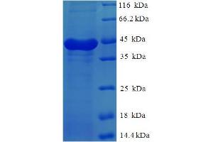 SDS-PAGE (SDS) image for Calpain, Small Subunit 1 (CAPNS1) (AA 1-268), (full length) protein (His-SUMO Tag) (ABIN5709195) (Calpain S1 Protein (AA 1-268, full length) (His-SUMO Tag))