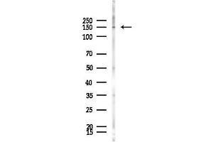 anti-Homeodomain Interacting Protein Kinase 1 (HIPK1) (N-Term) antibody