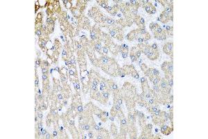 Immunohistochemistry of paraffin-embedded human liver injury using COX5B antibody at dilution of 1:100 (x40 lens). (COX5B Antikörper)