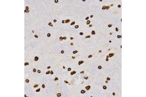 Immunohistochemistry (IHC) image for anti-Histone H4 (2meLys20) antibody (ABIN3016048)