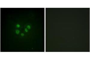 Immunofluorescence analysis of A549 cells, using Bloom Syndrome (Ab-99) Antibody. (Bloom Syndrome (AA 65-114) Antikörper)