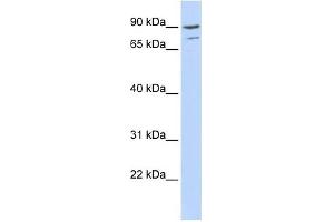 AKAP8 antibody used at 0. (AKAP8 Antikörper  (Middle Region))